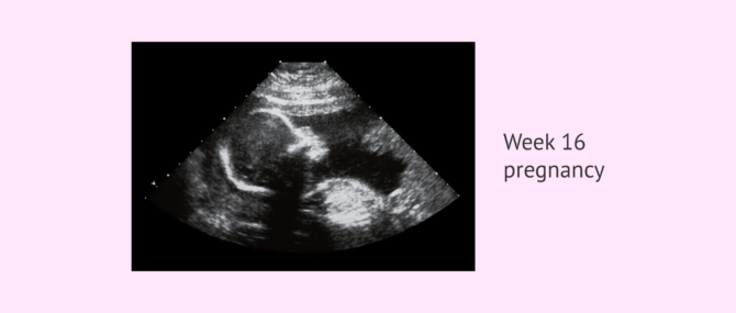 Imagen: Ultrasound scan in the 16th week of pregnancy