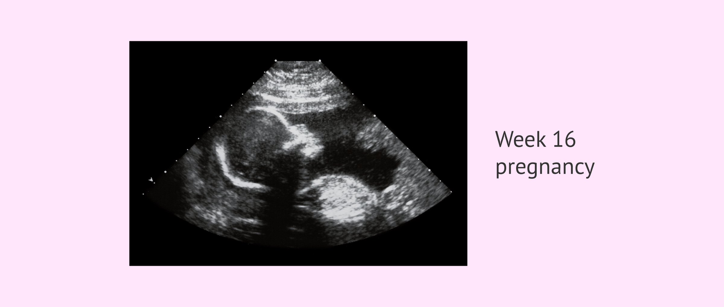 Ultrasound scan in the 16th week of pregnancy
