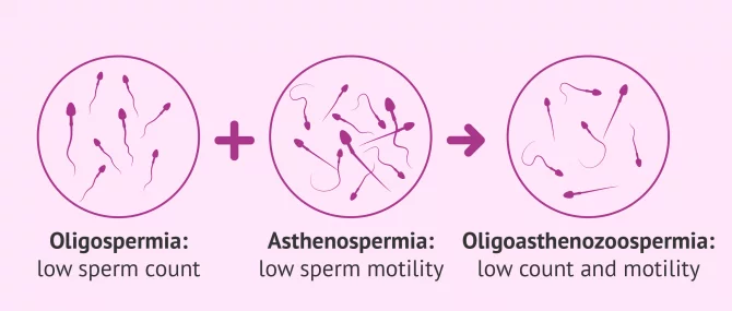 Oligoasthenozoopermia definition