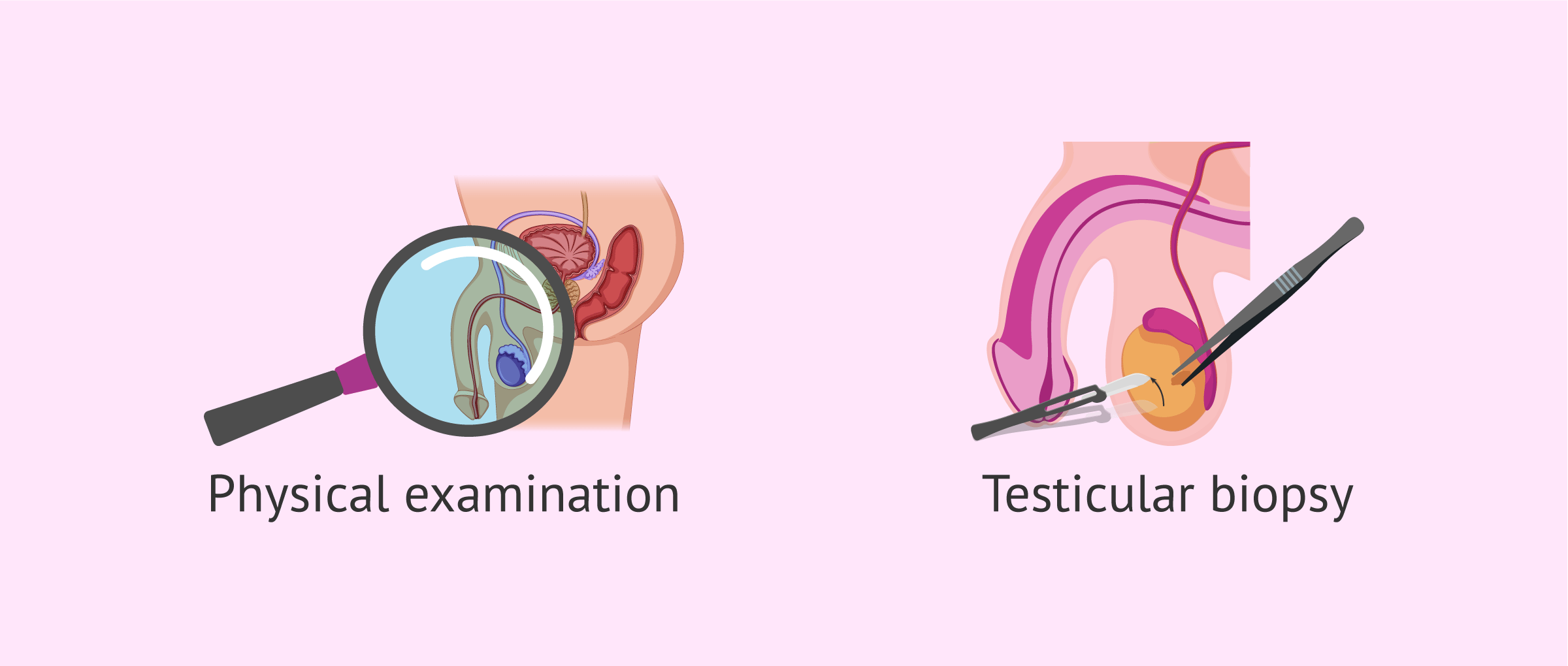 Imagen: Complementary tests for the diagnosis of azoospermia