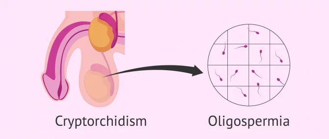 Erkak jinsiy olatni ayolni eshagi video