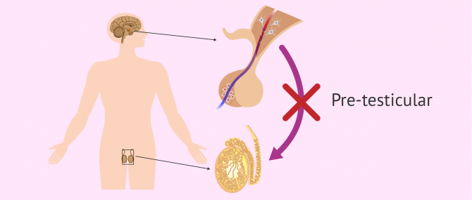 Pre-testicular causes of azoospermia