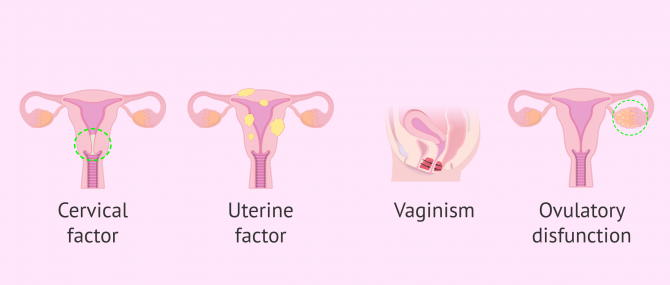 Imagen: Indications of AIH for female sterility