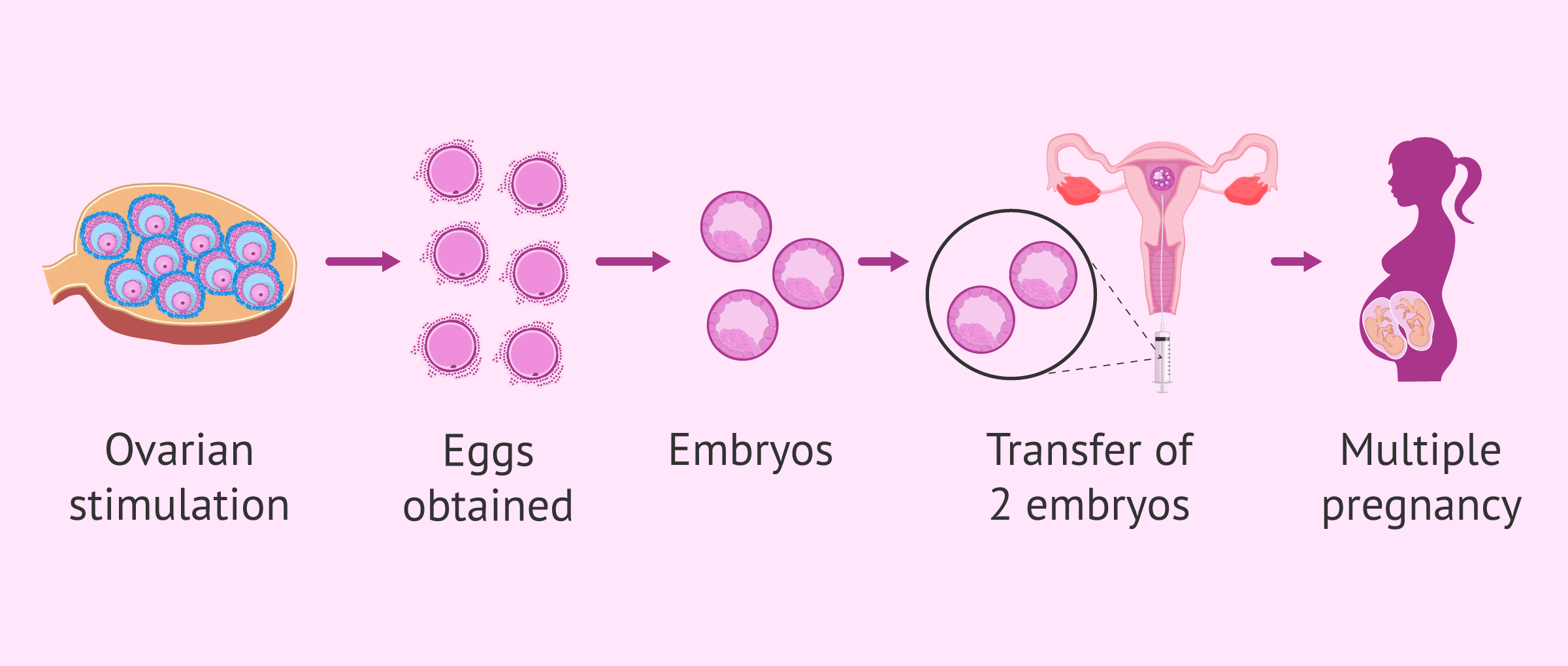 Cuanto cuesta la fecundacion in vitro