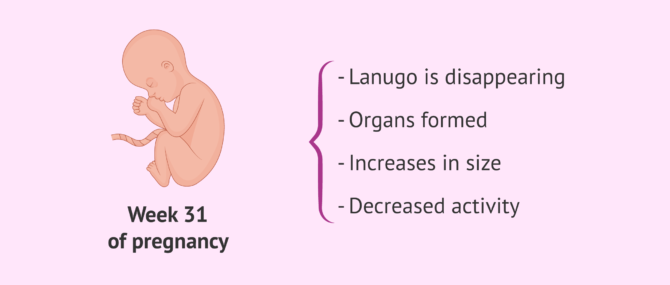 Imagen: Fetus in the 31st week of pregnancy