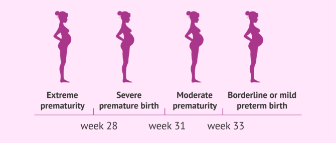 Imagen: 32nd week of pregnancy and preterm birth