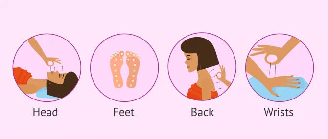 Imagen: Acupuncture points action