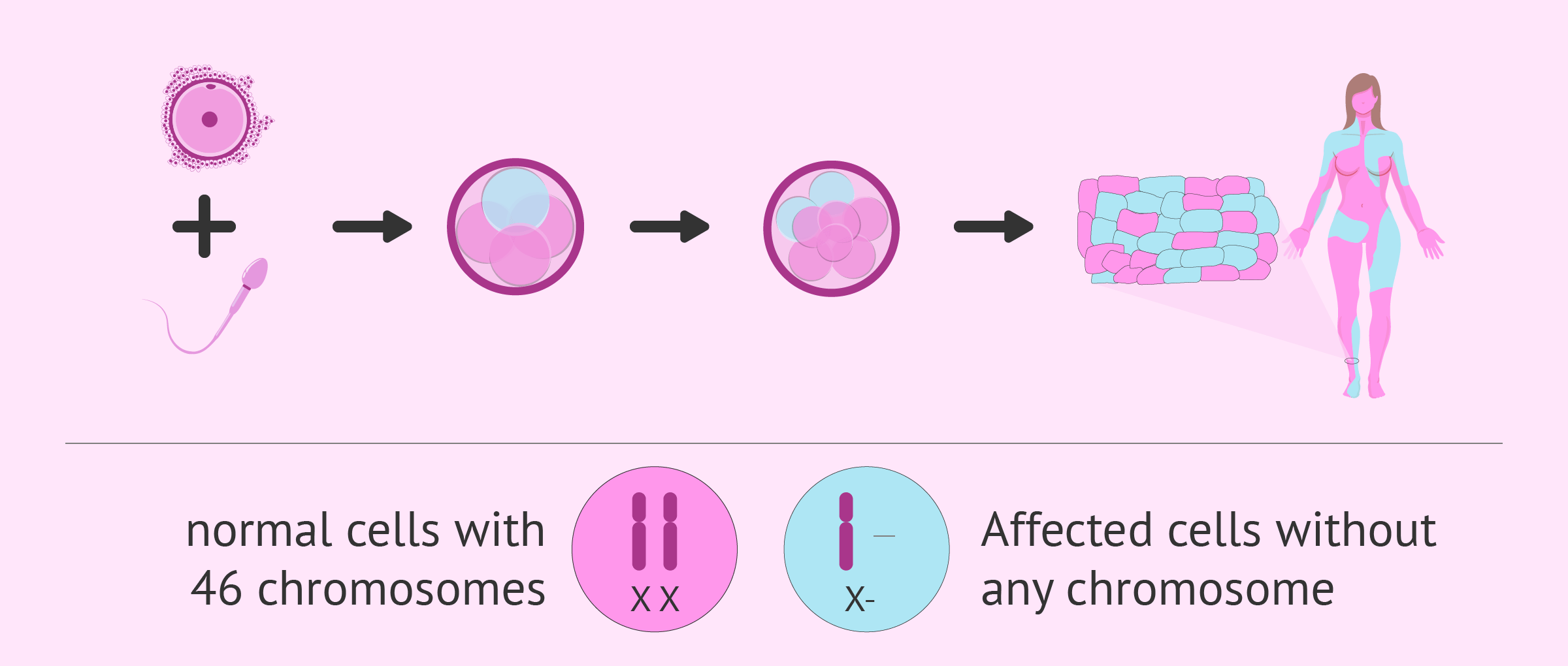 Causes Of Mosaicism In Turner Syndrome