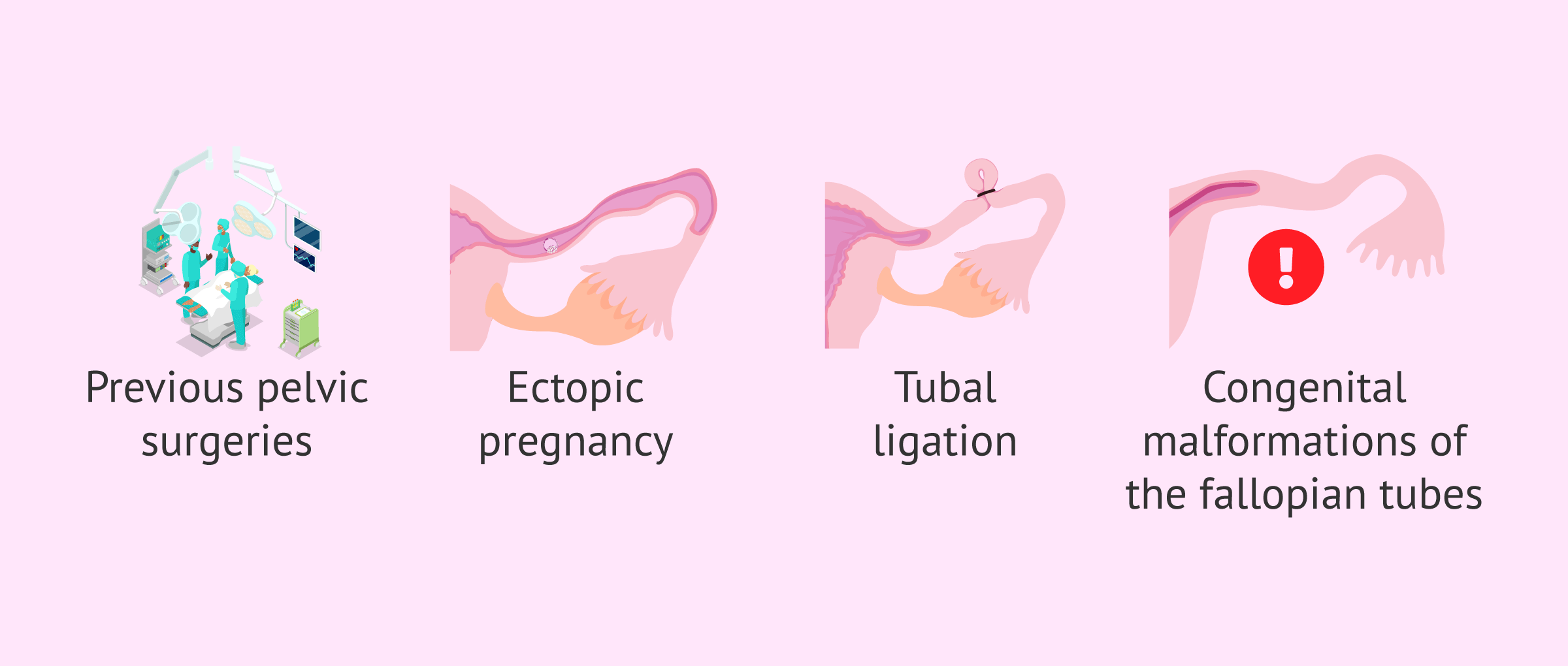 Imagen: Other causes of tubal factor