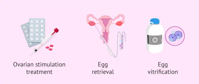 Imagen: oocytes vitrification