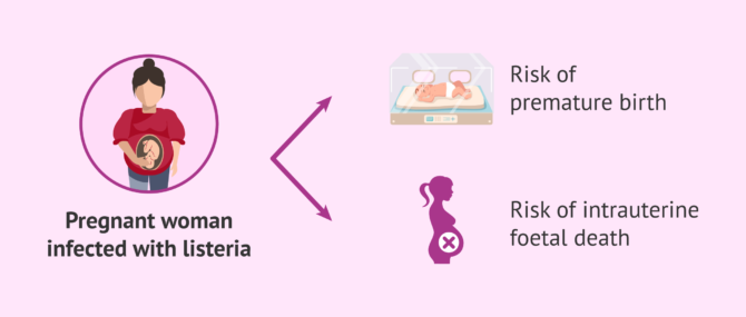 Imagen: Consequences of listeria in pregnancy