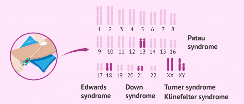 Invasive Test Invasive and Non-Invasive Prenatal Diagnostic Tests
