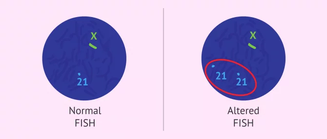 Imagen: FISH study of sperm