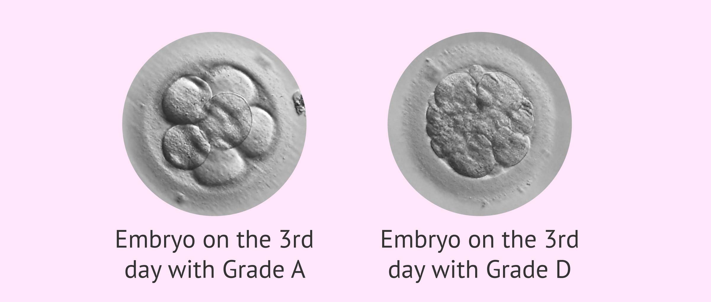 Classification of the embryos on the 3rd day of development