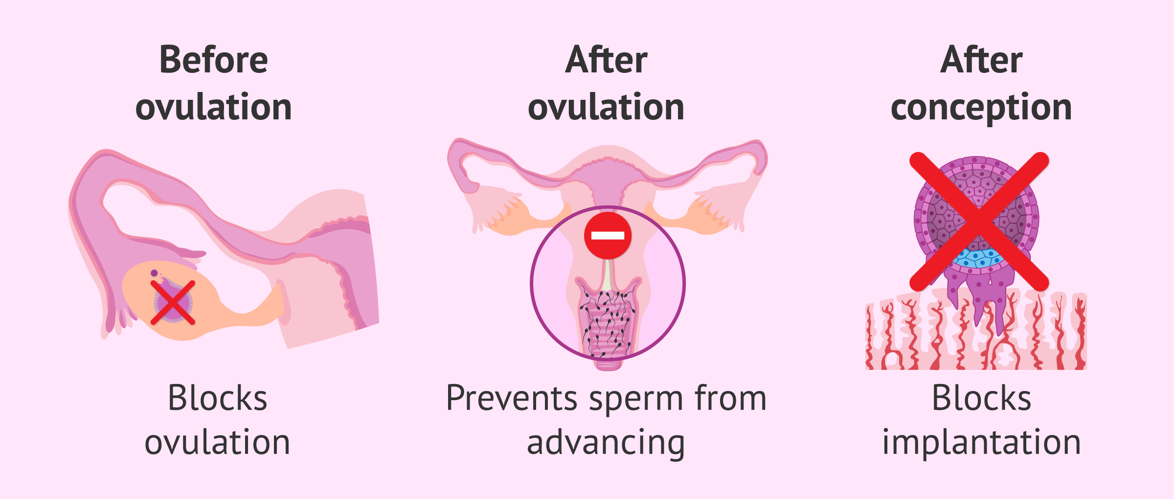 Plan B After Ovulation Does Work