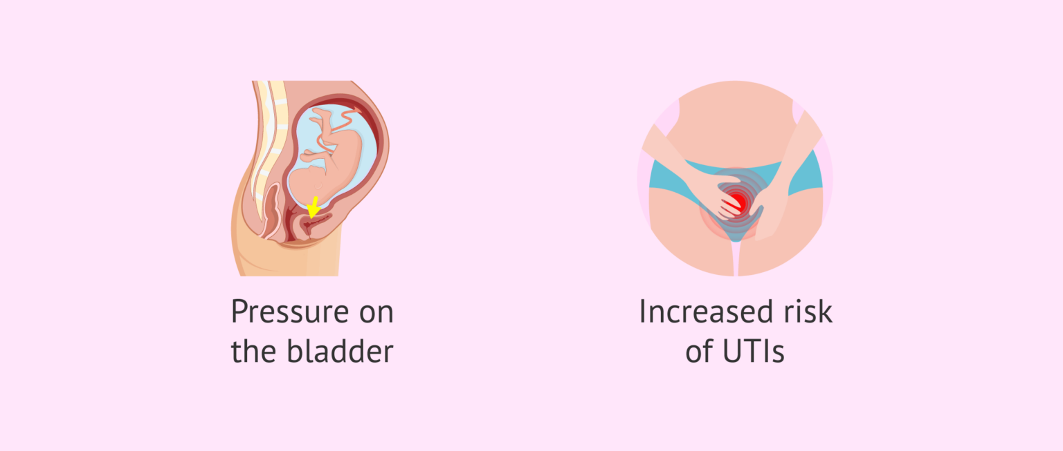 Renal and urinary changes in pregnancy
