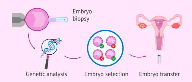 Imagen: PGD and embryo selection