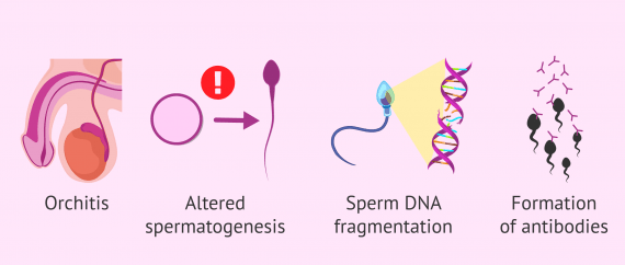 Symptoms Of STDs In Men