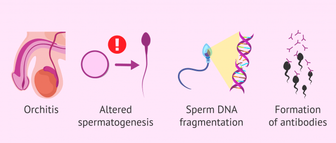 Imagen: Symptoms of STDs in men