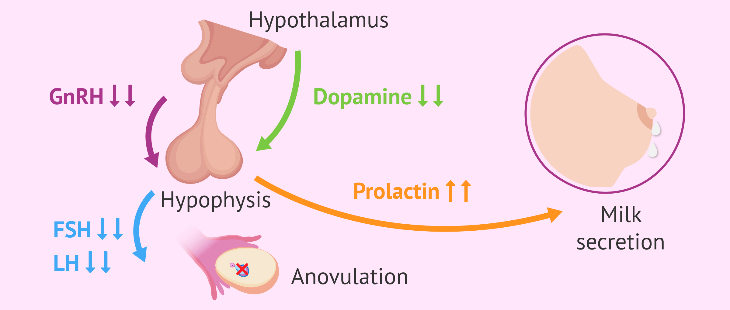 Que significa tener la prolactina alta