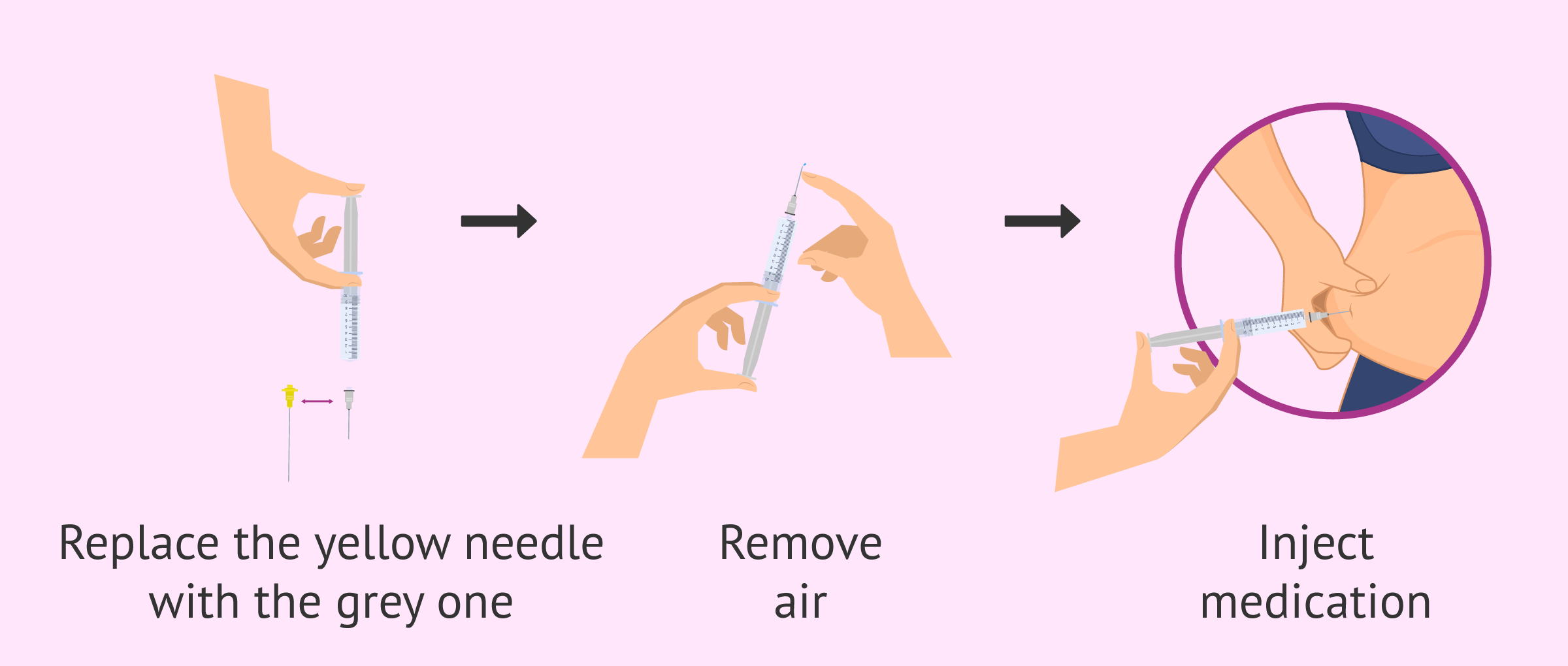 Self-injection of Cetrotide