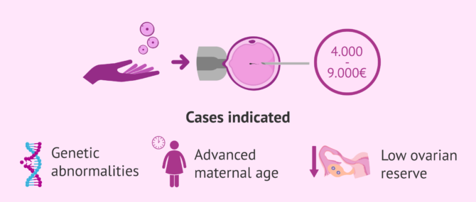 Imagen: Cost of IVF with Ovodonation