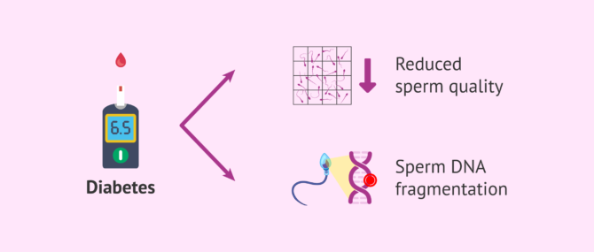 Imagen: Effects of diabetes on male fertility