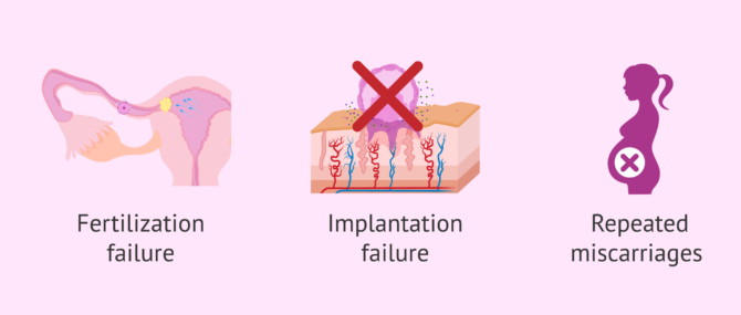 Imagen: How do fibroids affect fertility?