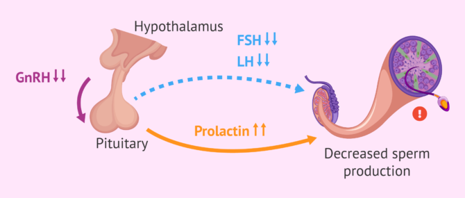 Imagen: Effect of hyperprolactinaemia on male fertility
