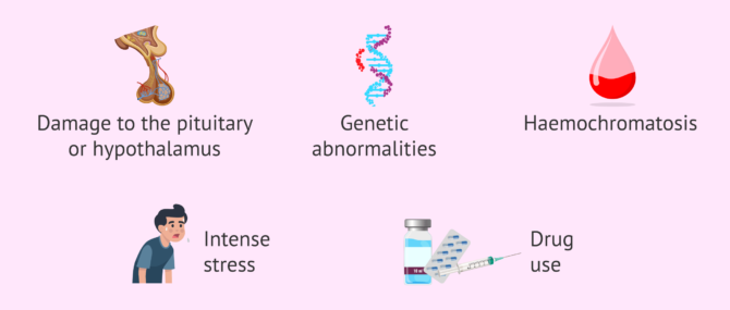 Imagen: Causes of hypogonadotropic hypogonadism