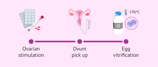 Imagen: The egg vitrification process