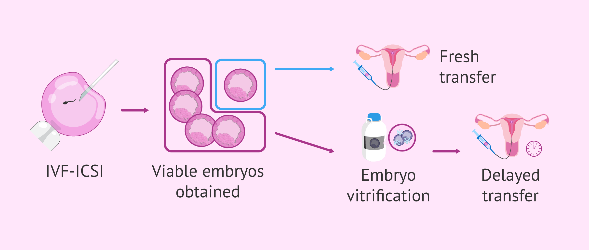 Imagen: Perinatal outcomes after fresh or deferred transfer