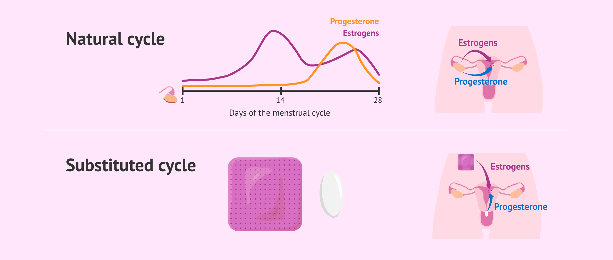 Imagen: Types of endometrial preparation for frozen embryo transfer