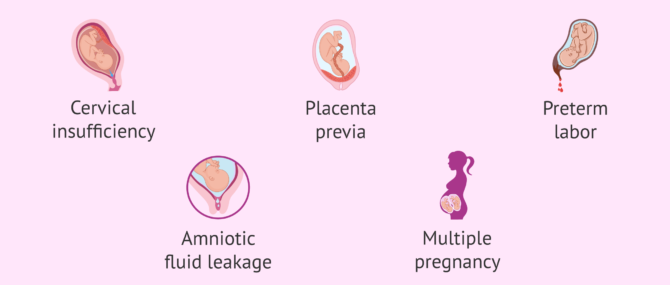 Imagen: When should sex be avoided in pregnancy?