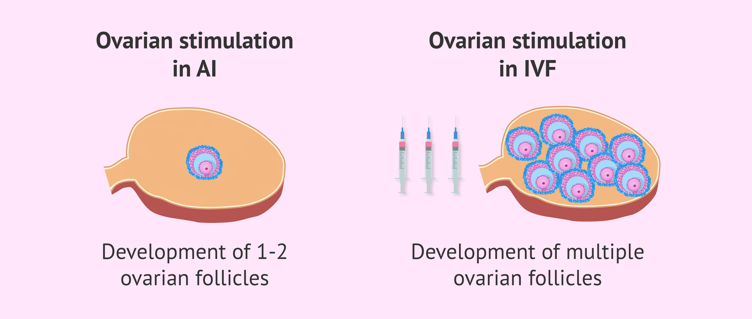 Follicular development in ovarian stimulation for AI and IVF