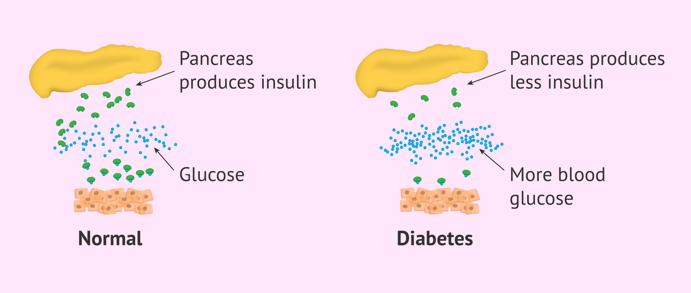 Why does diabetes occur?