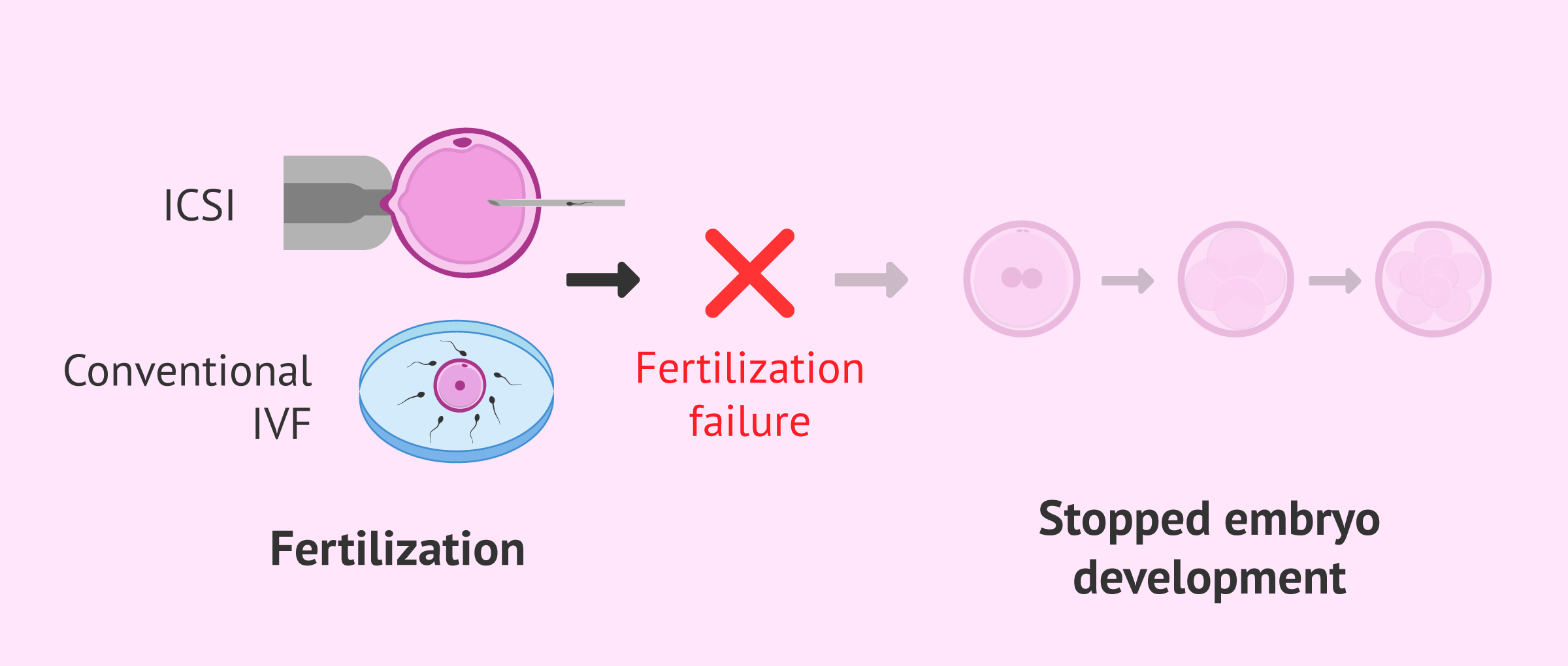 fertilization-failure