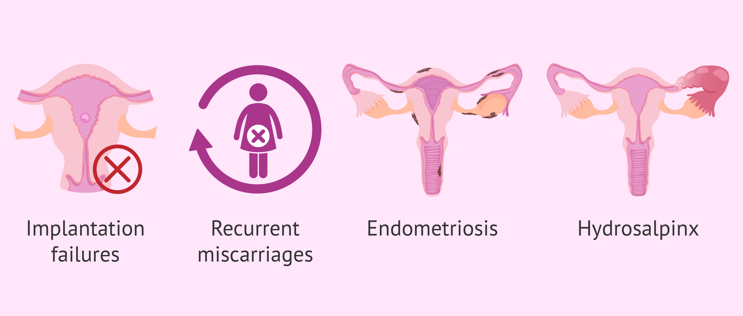 When is the endomeTRIO test recommended?