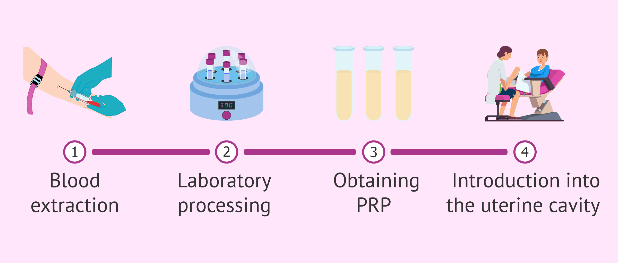 Imagen: Platelet-rich plasma to improve pregnancy chances