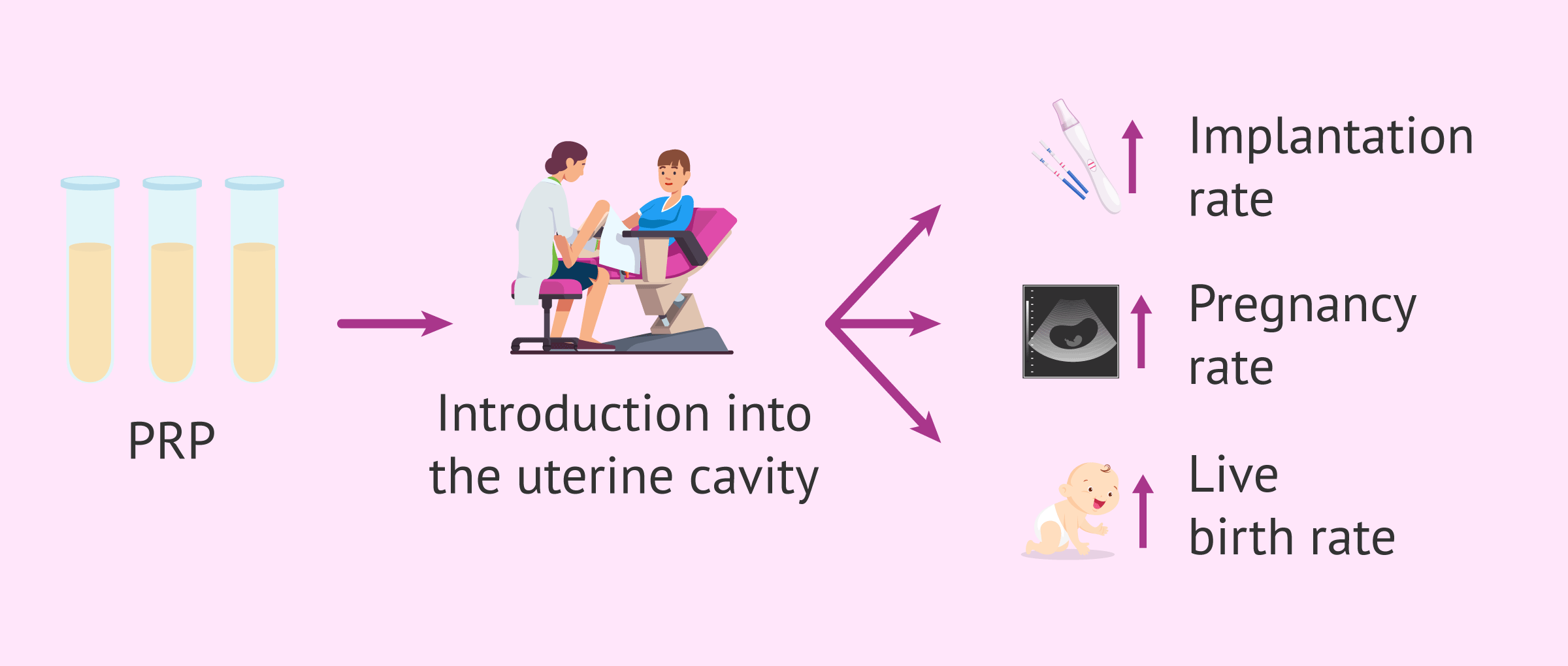 Imagen: Is platelet-rich plasma effective in assisted reproduction?