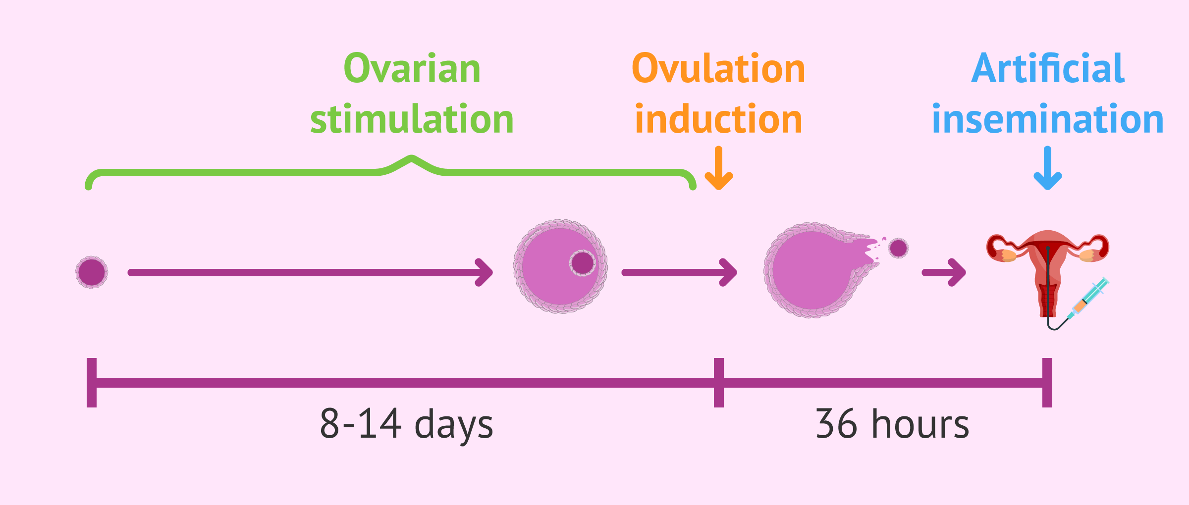 Imagen: Ovarian stimulation in artificial insemination