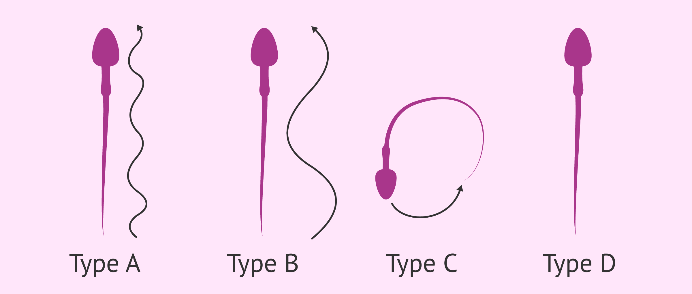 Motility Range Chart