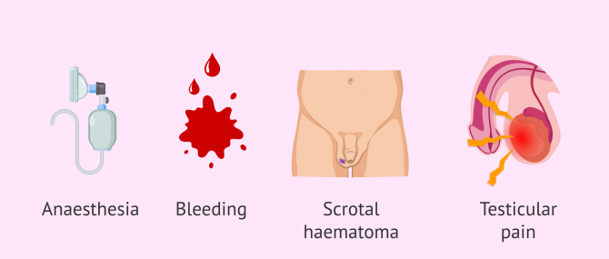 Imagen: What are the risks of testicular biopsy?