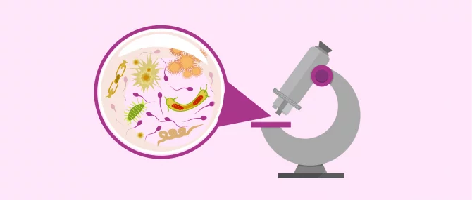 Imagen: Detecting pathogens in semen culture