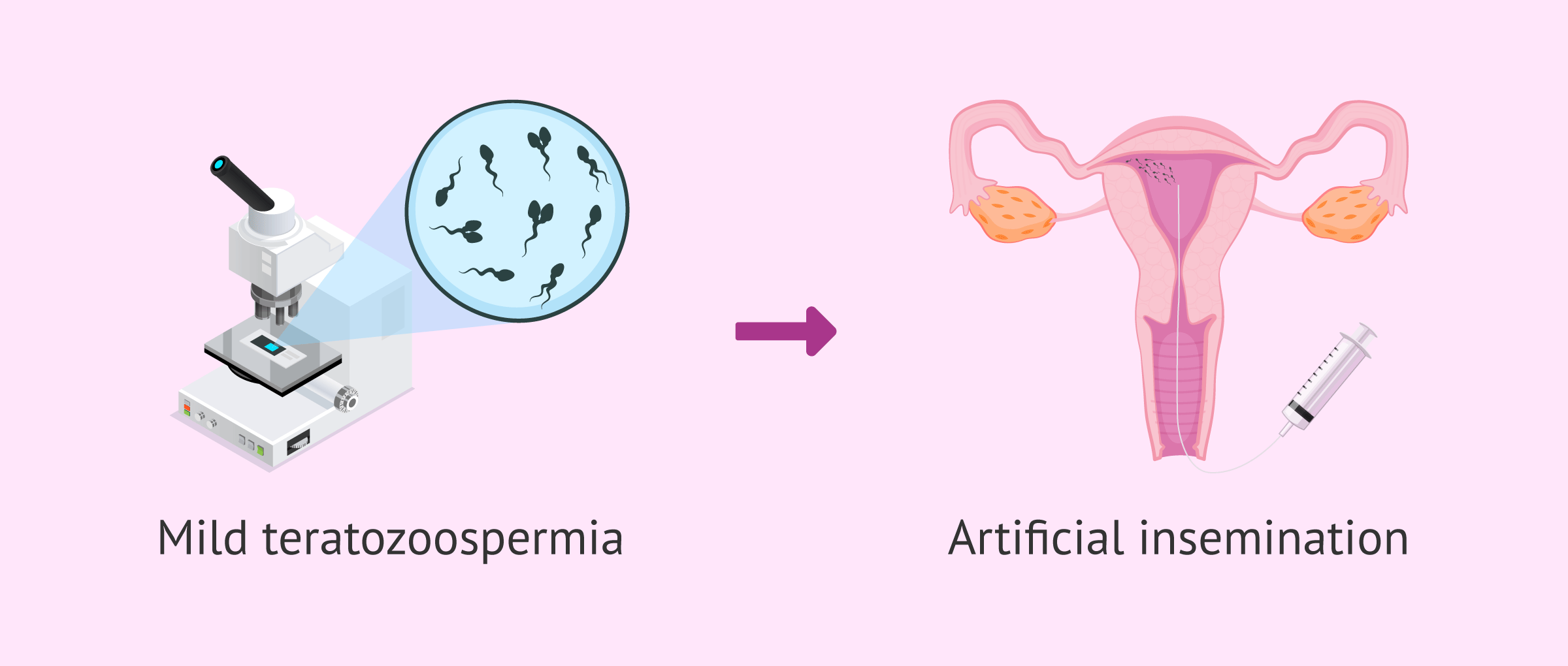AI for patients with teratozoospermia