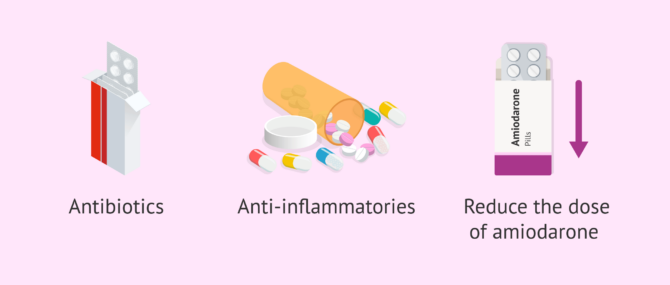 Imagen: Possible treatments for epididymitis