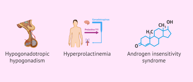 Imagen: Possible pretesticular causes of azoospermia