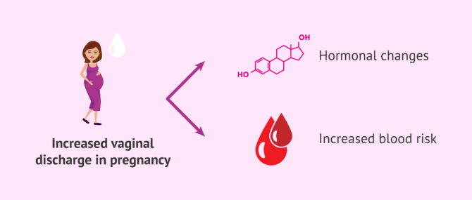 Imagen: Causes of increased vaginal discharge in pregnancy