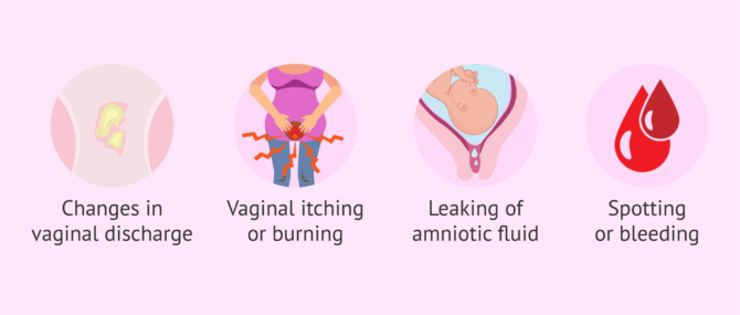Imagen: When to consult a gynecologist about vaginal secretions