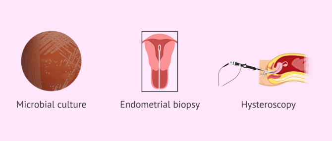Imagen: Diagnosis of endometritis